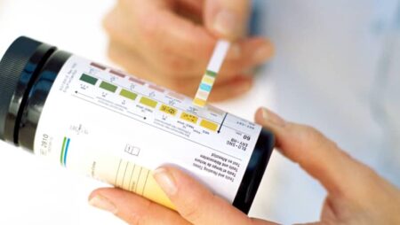 How To Use Keto Diet Testing Strips To Measure Ketosis